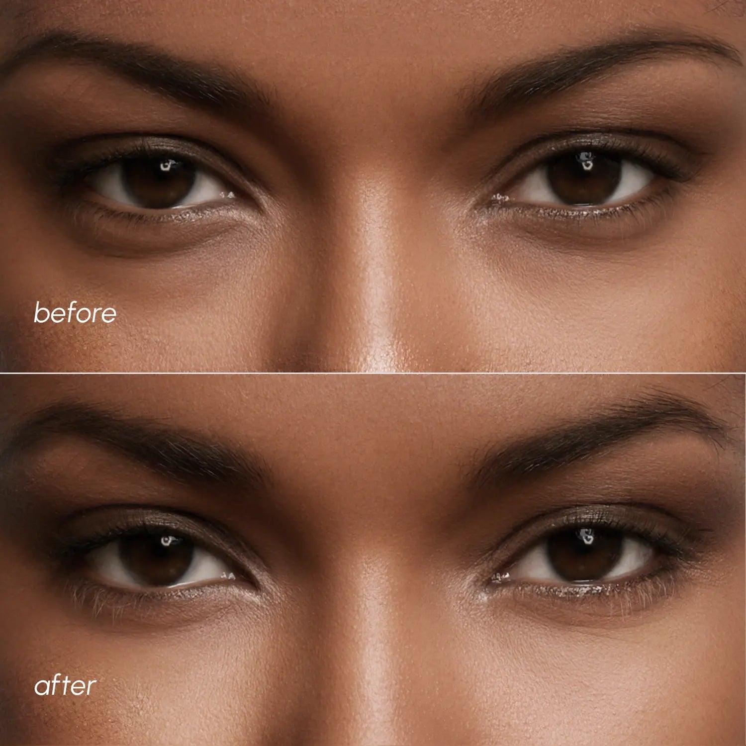 Violet Eye Patches for Dark Circles